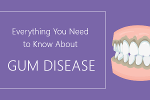 Pineville dentist, Dr. Gauthier at Today's Dental, talks about the important facts about gum disease that you should know about.